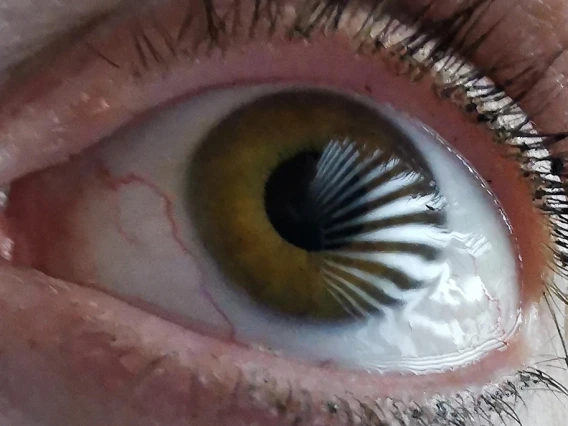 A close up image of the human eye.
